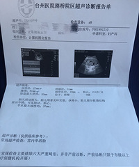 ��������ˮ�ݱ��������ռǡ�+ϲ�ǲΰ�Ķ�̥