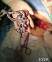 ����Ƴ��й���