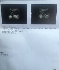 ��������ˮ�ݱ��������ռǡ��ڴ�С�����Ľ���