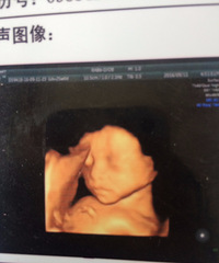 ��������ˮ�ݱ��������ռǡ�+�����е�����