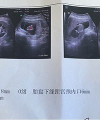 ��������ˮ�ݱ��������ռǡ�+�ڴ���ͥ�³�Ա