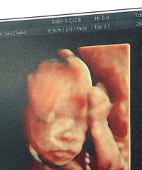 ��ά�����ˣ�����������ࡣ