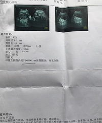 ��������ˮ�ݱ��������ռǡ�+ �����ҵα���