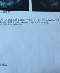 ��������ˮ�ݱ��������ռǡ�+Ԥ����10.5 ��¼��