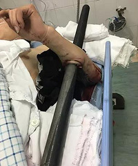 �����ֱ۱�����