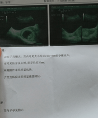 【漾子亲水馆·孕妈日记】等待九月