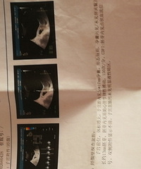 ��������ˮ�ݱ��������ռǡ�