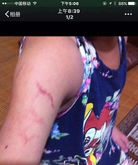 ����ʦ�����˶�Ĥ