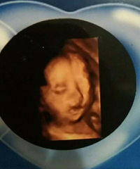 ��������ˮ�ݱ��������ռǡ�С���������ϵ�