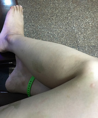 "驱蚊手环有用吗"
