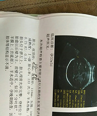 【漾子亲水馆杯·孕妈日记】 快预产期了,椒江有孕妈吗