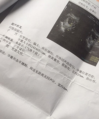今年元旦期间的预产期的妈咪看过来