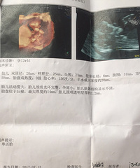 ����Ԫ���ڼ��Ԥ���ڵ����俴����