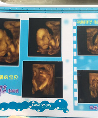 ��������ˮ�ݱ��������ռǡ�+�������ٵ�С��ϲ