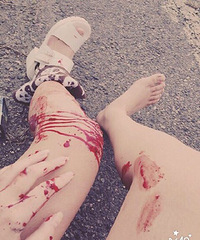 ���ӳ�������˦�����⣬��һ���������Ļ�Ҫ�Ӹ��˾�