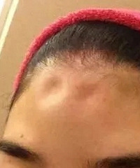 ��wanghong���������˸���