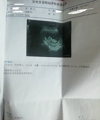 Ϊ���պ�������飨�����ռǣ�