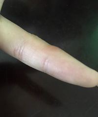 ���۸��᡿���ֻ����㣬СĴָ�Ƿ��ѱ��Σ�