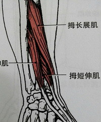 "有种腱鞘炎叫“妈妈手”,宝妈们要注意啦"