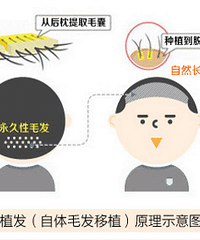 "重庆治疗脱发好的医院东方植发教你头发保养小知识!!!"
