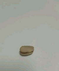 带鱼也有结石?吃出一个小蚕豆一样的东西