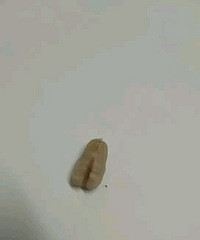 带鱼也有结石?吃出一个小蚕豆一样的东西