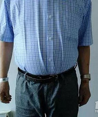 ���ţ����ݴ󲮳Ե��ϰ�֧��Ƥ��ƽ�����࣬ҽ��һ�ʶ�����