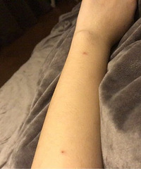 刚怀孕 身上痒脸上也痒