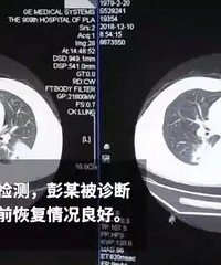 �������˳�����һ��Ҫ��һ�£����Ⱦ�������ʼ��ߵĲ���̫���£�