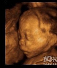 突如其来的惊喜(孕妈日记)