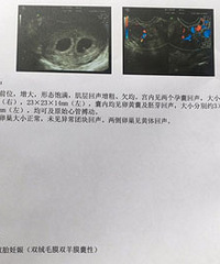 ����˫��̥��Ե�����˾�����ô�ٶ�