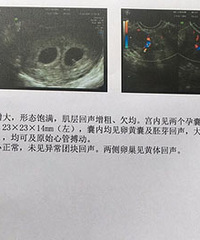 һ������˫��̥�ı��裬��������˫��̥ѽ