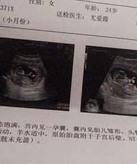 ����һ��ͼ˵��������