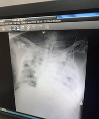 ·�Ŷ���ҽԺ���Ҹ������������йز��������������ϰ���