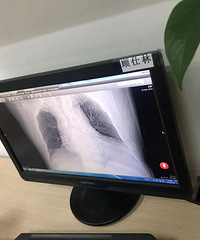 ·�Ŷ���ҽԺ���Ҹ������������йز��������������ϰ���