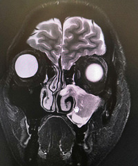 �㽭7���к�ÿ������Ѫ��ֹ���ҳ�����ʧ�룡���ֲ��ѽ���߷���