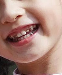 ������ֺö��׶����ݶ��Ǻڵģ�����ô�����أ�