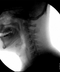 X���µ�����Ͷ�����Ϊ�о�