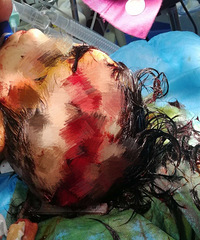 �����ؾ���6����ͯ��65���ھ�׷������