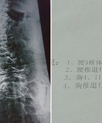 �Ǵ̱Ƚ϶࣬��ɶ���ư취û�أ�