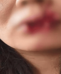 Ů��ι���촽��ҧһȱ