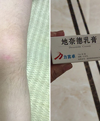 3��С����ҩ�󣬳���������ë