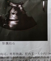 ����ʯ����һ��Ҫժ������