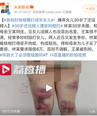 ����ұ�30��δ��Ů������ʹ��˱���Ҫ�����