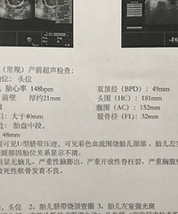 ̥������ƾ�һȦ�������𣿸���ô�죿