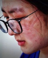 ̽��̨���й�������ҽѧ���ĸ��벡��ح3���߳�7���������˱���