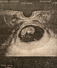 лл���� �ҵ�С��������ռǣ�