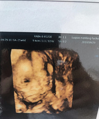 ����ӵ����һ��С�ɰ�+�������ռǡ�