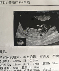 ��ӭ�ҵ���ʹ�����������ռǡ�