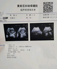 ���ڵȵ��㣨�����ռǣ�